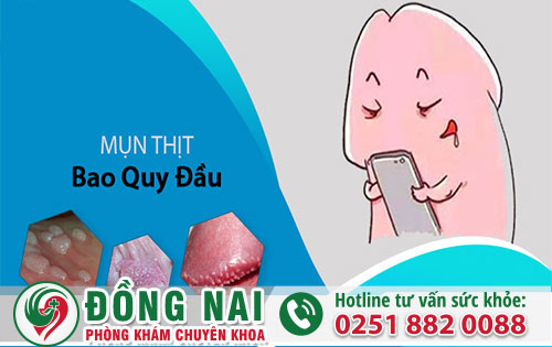 Nguyên Nhân Bao Quy Đầu Dương Vật Nổi Mụn Thịt