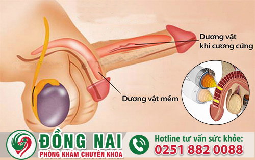 Cải Thiện Dương Vật Không Cứng Bằng Cách Nào?