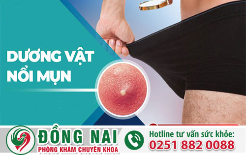 Những Biến Chứng Khi Nam Giới Bị Mụn Dương Vật