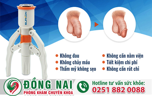 Phương pháp xâm lấn tối thiểu công nghệ Hàn Quốc