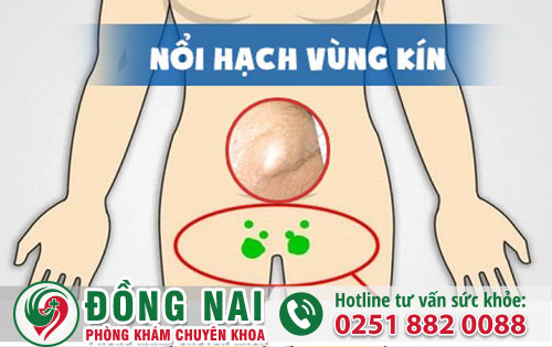 Tổng Quan Về Tình Trạng Nổi Hạch Ở Bộ Phận Sinh Dục Nam